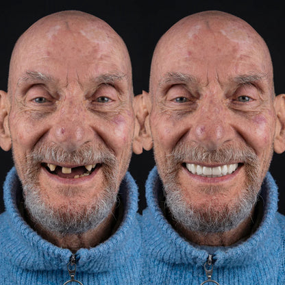 LUMÉ™ SmileForm Diş Seti