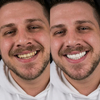 LUMÉ™ SmileForm Diş Seti